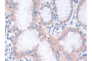 Detection of CTNNa1 in Human Stomach Tissue using Polyclonal Antibody to Catenin Alpha 1 (CTNNa1) (CTNNA1 抗体  (AA 2-228))