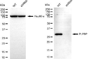 anti-Pyridoxal Phosphate Homeostasis Protein (PLPBP) antibody