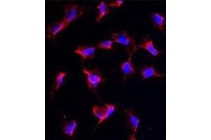 Immunofluorescence analysis of anti-NANOS1 Antibody (C-term) in HeLa cells. (Nanos Homolog 1 抗体  (C-Term))