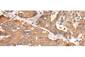 Immunohistochemistry (Paraffin-embedded Sections) (IHC (p)) image for anti-ATP Synthase, H+ Transporting, Mitochondrial F1 Complex, gamma Polypeptide 1 (ATP5C1) antibody (ABIN7252273)