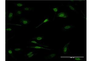 Immunofluorescence of monoclonal antibody to PRDM1 on HeLa cell. (PRDM1 抗体  (AA 422-493))
