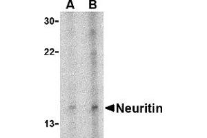 Western Blotting (WB) image for anti-Neuritin 1 (NRN1) (Middle Region) antibody (ABIN1031012) (NRN1 抗体  (Middle Region))