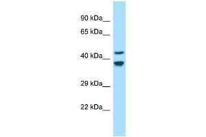 Western Blotting (WB) image for anti-Gliomedin (GLDN) (N-Term) antibody (ABIN2790542) (GLDN 抗体  (N-Term))