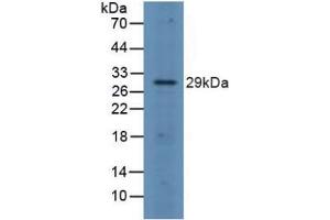 Detection of FOSL1 in Rat Spleen Tissue using Polyclonal Antibody to FOS Like Antigen 1 (FOSL1) (FOSL1 抗体  (AA 1-271))