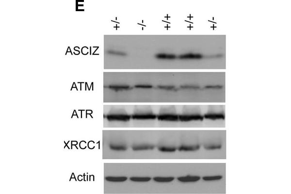 ATM Antikörper  (pSer1981)