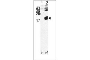 Image no. 1 for anti-beta-2-Microglobulin (B2M) (N-Term) antibody (ABIN357931) (beta-2 Microglobulin 抗体  (N-Term))