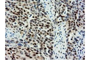 Immunohistochemical staining of paraffin-embedded Human Kidney tissue using anti-NT5DC1 mouse monoclonal antibody. (NT5DC1 抗体)