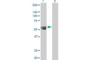 Western Blot analysis of HMGCS2 expression in transfected 293T cell line by HMGCS2 monoclonal antibody (M06), clone 1E9.
