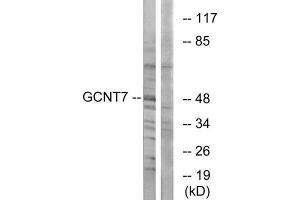Western Blotting (WB) image for anti-Glucosaminyl (N-Acetyl) Transferase Family Member 7 (GCNT7) (C-Term) antibody (ABIN1850894) (GCNT7 抗体  (C-Term))