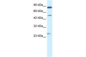 Western Blotting (WB) image for anti-Chloride Channel, Voltage-Sensitive 6 (CLCN6) antibody (ABIN2461139) (CLCN6 抗体)