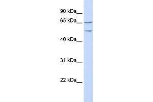 WB Suggested Anti-TTYH1 Antibody Titration:  0. (TTYH1 抗体  (N-Term))
