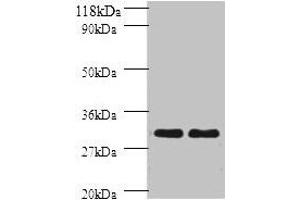 Western blot All lanes: HLA-DPB1 antibody at 2 μg/mL Lane 1: sw1990 whole cell lysate Lane 2: HGC27 whole cell lysate Secondary Goat polyclonal to rabbit IgG at 1/10000 dilution Predicted band size: 30 kDa Observed band size: 30 kDa (HLA-DPB1 抗体  (AA 30-225))