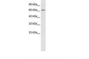 Image no. 1 for anti-Zinc Finger Protein 649 (ZNF649) (AA 436-485) antibody (ABIN202680) (ZNF649 抗体  (AA 436-485))