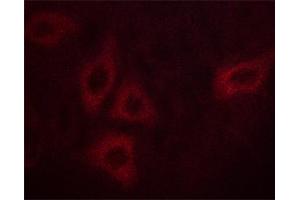 ABIN6267562 staining HepG2 cells by ICC/IF. (Calmodulin 1 抗体  (pSer81, pThr79))