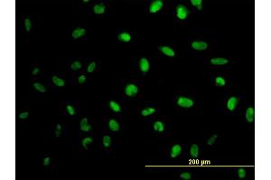 Immunofluorescence of monoclonal antibody to MPG on HeLa cell. (MPG 抗体  (AA 1-90))