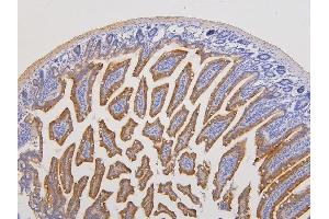 IHC analysis of RAB3GAP2 using anti-RAB3GAP2 antibody (ABIN6719633). (RAB3GAP2 抗体  (AA 1-115))