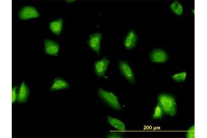 Immunofluorescence of monoclonal antibody to G3BP on HeLa cell. (G3BP1 抗体  (AA 214-303))