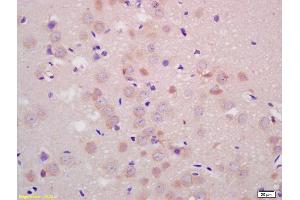 Formalin-fixed and paraffin embedded rat brain labeled with Anti-Parkin protein/PARK2 Polyclonal Antibody, Unconjugated (ABIN735578) at 1:200 followed by conjugation to the secondary antibody and DAB staining. (Parkin 抗体  (AA 361-465))