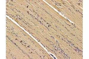ABIN7095950 and ABIN7100012 at 1/100 staining rat muscle tissue by IHC-P. (SCYL3 抗体)