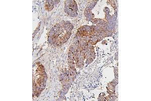 IHC analysis of CDK1 using anti-CDK1 antibody (ABIN7602240). (CDK1 抗体  (AA 66-297))
