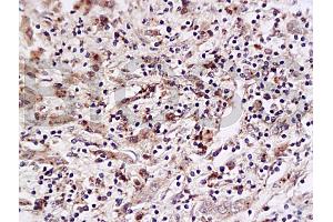 Immunohistochemistry (IHC) image for anti-Placenta Growth Factor (PGF) (AA 166-221) antibody (ABIN727235) (PLGF 抗体  (AA 166-221))