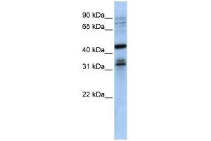 MSI2 antibody used at 1 ug/ml to detect target protein. (MSI2 抗体)