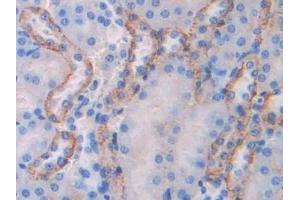 Immunohistochemistry (IHC) image for anti-Coagulation Factor V (F5) (AA 1776-2028) antibody (ABIN7438928)