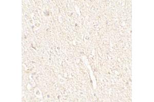 Immunohistochemistry (IHC) image for anti-Energy Homeostasis Associated (ENHO) (C-Term) antibody (ABIN2457882) (ENHO 抗体  (C-Term))