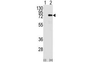 Western Blotting (WB) image for anti-Protein Kinase C, eta (PRKCH) antibody (ABIN3002933) (PKC eta 抗体)