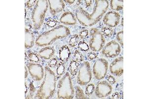 Immunohistochemistry (IHC) image for anti-Prosaposin (PSAP) (AA 60-310) antibody (ABIN3022606)