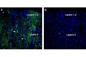 Expression of Neogenin in rat parietal cortex. (Neogenin 1 (NEO1) Peptide)