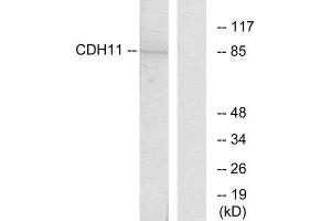 Western Blotting (WB) image for anti-Cadherin 11 (CDH11) (Internal Region) antibody (ABIN1850214) (OB Cadherin 抗体  (Internal Region))