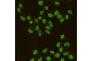 Immunocytochemistry staining of HeLa cells fixed with 4 % Paraformaldehyde and using SAFB1 mouse mAb (dilution 1:200). (SAFB 抗体)