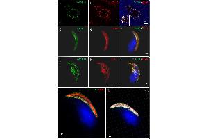 Localization of mTAS1R3 (green) and CD46 (red) in mouse sperm revealed by Confocal Microscopy and Structure Illumination Microscopy (SIM).