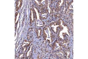 IHC analysis of TOMM34 using anti-TOMM34 antibody (ABIN7599253).