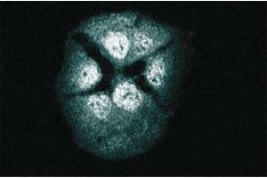 Immunofluorescence staining of A431 cells. (RAP1 抗体  (AA 1-184))