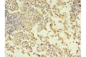 Immunohistochemistry of paraffin-embedded human thymus tissue using ABIN7150034 at dilution of 1:100 (A Disintegrin and Metallopeptidase Domain 1a (ADAM1A) (AA 214-504) 抗体)