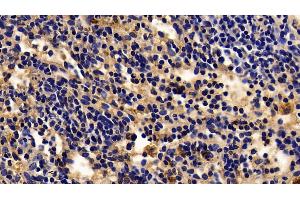 Detection of ACP5 in Rabbit Spleen Tissue using Polyclonal Antibody to Acid Phosphatase 5, Tartrate Resistant (ACP5) (ACP5 抗体  (AA 74-321))