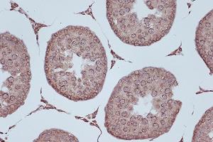 Immunohistochemistry of paraffin-embedded rat testis using RanG Rabbit mAb (ABIN7269846) at dilution of 1:100 (40x lens). (RANGAP1 抗体)