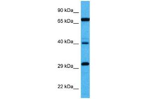 Host:  Mouse  Target Name:  DMTF1  Sample Tissue:  Mouse Kidney  Antibody Dilution:  1ug/ml (DMP1 抗体  (Middle Region))