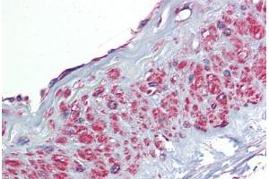 Human Vessel: Formalin-Fixed, Paraffin-Embedded (FFPE)