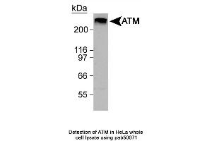 Image no. 1 for anti-Ataxia Telangiectasia Mutated (ATM) (C-Term) antibody (ABIN363380) (ATM 抗体  (C-Term))