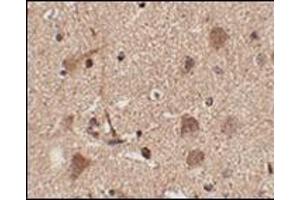 Immunohistochemistry of Slitrk5 in human brain tissue with this product at 2. (SLITRK5 抗体  (Center))