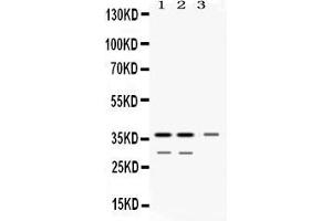 Western blot analysis of DDAH1 expression in rat kidney extract ( Lane 1), mouse kidney extract ( Lane 2) and HELA whole cell lysates ( Lane 3). (DDAH1 抗体  (C-Term))
