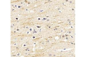 Immunohistochemistry (Paraffin-embedded Sections) (IHC (p)) image for anti-Sodium Channel, Voltage-Gated, Type VIII, alpha (SCN8A) antibody (ABIN7075647)