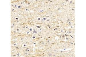 Immunohistochemistry analysis of paraffin-embedded mouse hippocampus using SCN8A (ABIN7075647) at dilution of 1: 1200 (SCN8A 抗体)