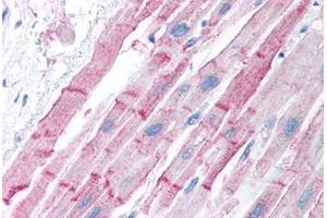 Immunohistochemistry (Paraffin-embedded Sections) (IHC (p)) image for anti-Estrogen Receptor 2 (ESR2) (AA 82-131) antibody (ABIN214750)