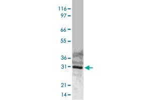 Western blot analysis of full-length, recombinant human BIRC7 using BIRC7 polyclonal antibody  at 1 : 2000. (BIRC7 抗体)
