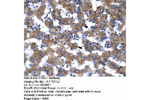 Rabbit Anti-VDAC1 Antibody  Paraffin Embedded Tissue: Human Liver Cellular Data: Hepatocytes Antibody Concentration: 4. (VDAC1 抗体  (C-Term))