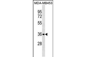 Western blot analysis in MDA-MB453 cell line lysates (35ug/lane). (Syntaxin 11 抗体  (N-Term))